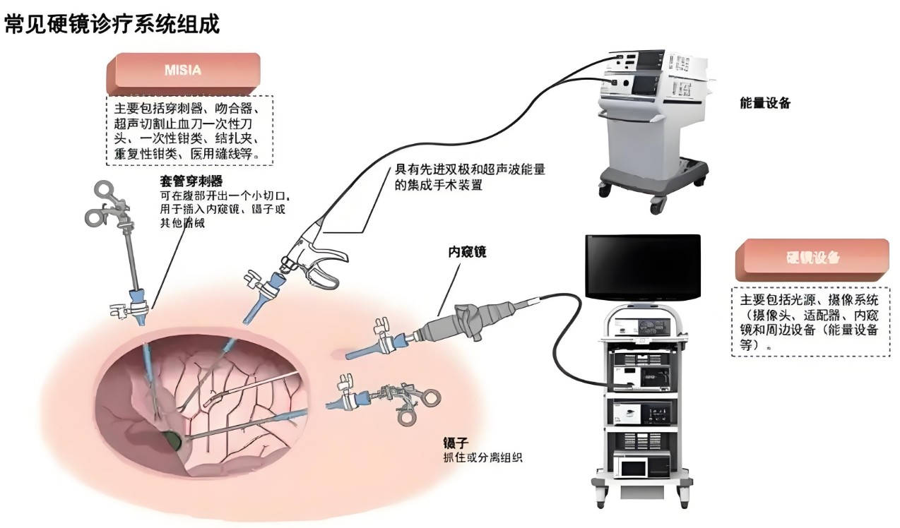 滤光片 常见硬镜诊疗系统组成